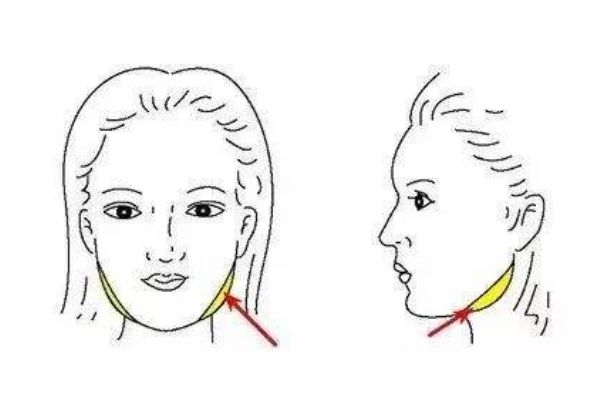 怎么改善咬肌肥大,咬肌肥大怎么办怎么瘦咬肌