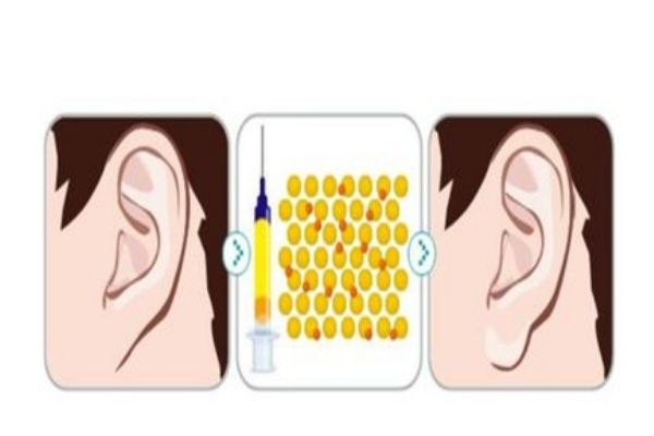 玻尿酸丰耳垂有危害吗,玻尿酸丰耳垂会改变命运吗