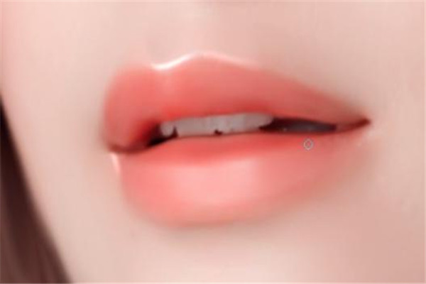 打了嘟嘟唇需要注意什么,嘟嘟唇做完注意事项
