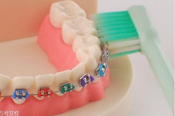 种植钉和支抗钉的区别,种植支抗钉的危害