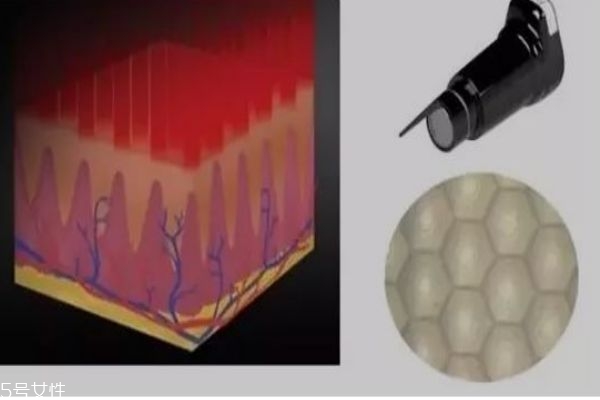 皮秒的作用是什么,皮秒的主要作用是什么