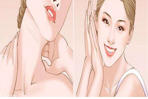 嗨体的作用是什么,嗨体主要作用