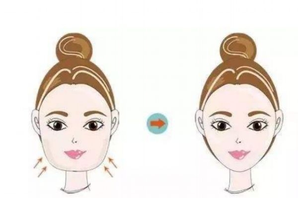 面部吸脂有什么用,面部吸脂有用吗