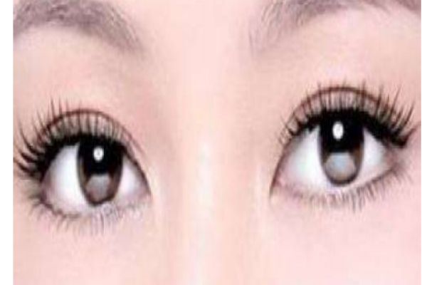 割双眼皮的最佳时间是什么时候,割双眼皮季节什么时候做最好