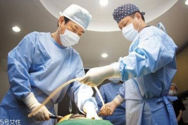 自体脂肪丰胸后怎么护理,自体脂肪丰胸后需要注意什么