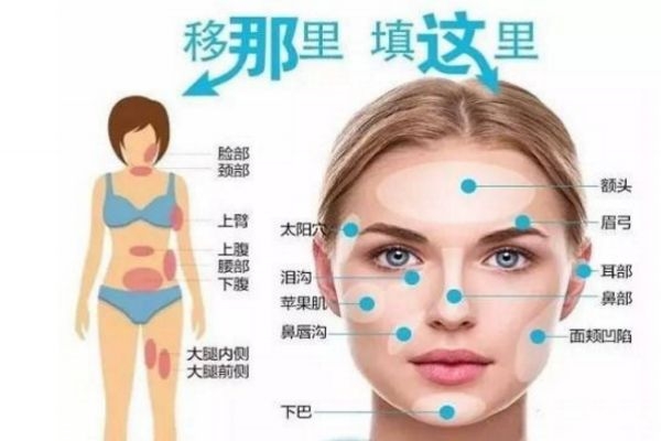 脂肪填充多久可以用洗面奶洗脸,脂肪填充多久可以用洗面奶