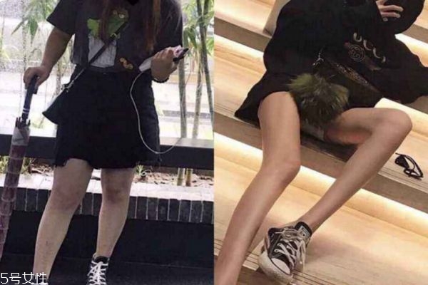 打了瘦腿针可以长时间走路吗,瘦腿针打了能走路吗