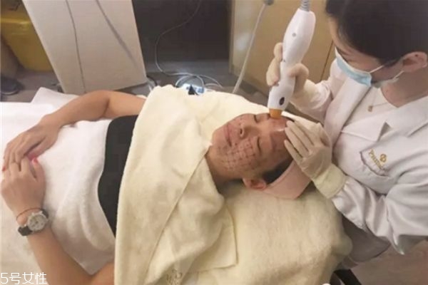 热玛吉的使用方法,热玛吉是什么效果