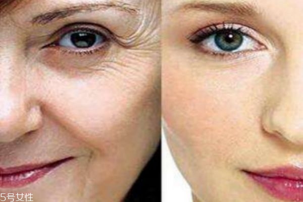 热玛吉和热玛吉哪个好,热玛吉到底好不好?