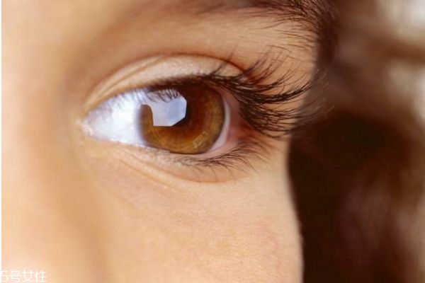 肿眼泡和脂肪眼肿区别,肿眼泡是因为眼部脂肪多吗