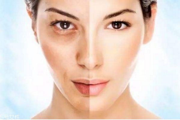 果酸换肤的优缺点,果酸换肤的危害