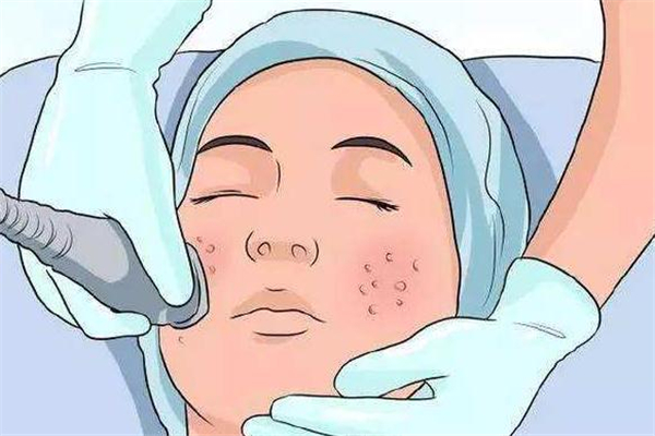 超微小气泡和小气泡的区别,超微小气泡有用吗