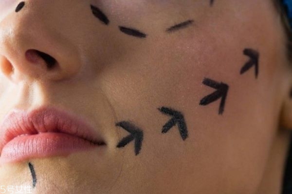 水光针有哪些功效,水光针的种类和功效