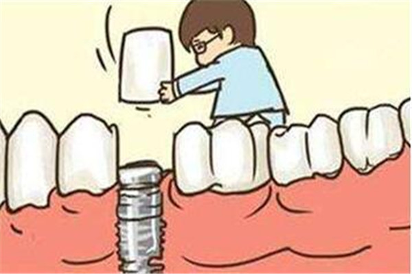 种植牙的利和弊,种植牙的坏处