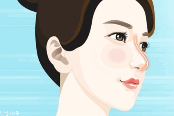 硅胶隆鼻一般几年取出,为什么隆鼻硅胶到一定时间要取出来