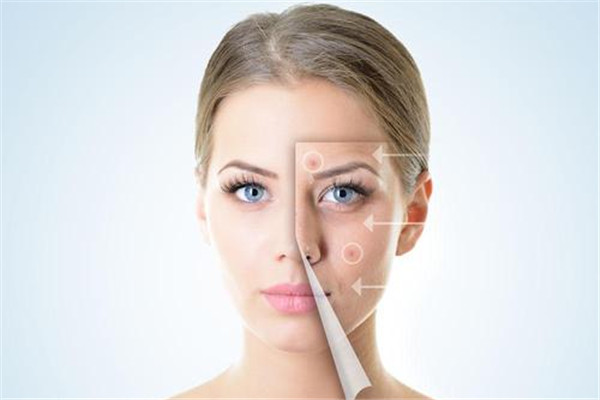 pst面部提升多少钱,做pst面部提升术需要多少钱