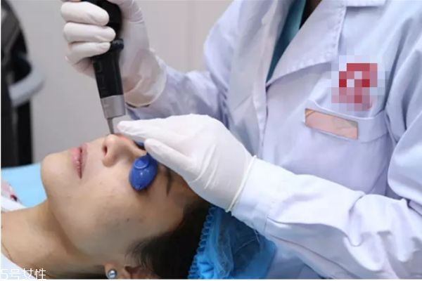 皮秒激光祛斑痛不痛,皮秒祛斑痛不痛