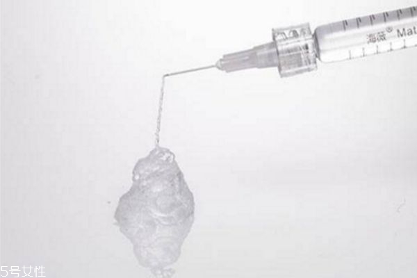 玻尿酸隆鼻会有后遗症吗,大分子玻尿酸隆鼻会变宽吗