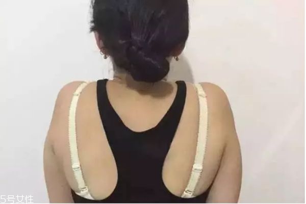 瘦肩针注射过程中恶心,瘦肩针注射过程 瘦肩针注射过程中恶心,瘦肩针注射过程