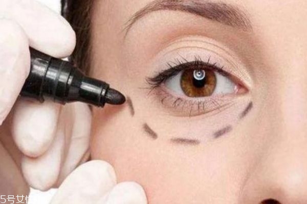 内切眼袋需要拆线吗,内切眼袋手术需要拆线吗