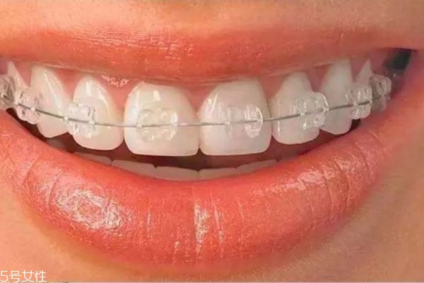 牙齿整形的危害有哪些,牙齿整形的利和弊 牙齿整形的危害有哪些,牙齿整形的利和弊