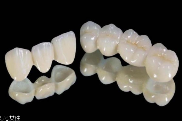 美容冠矫正牙齿的危害,美容牙冠好还是矫正牙齿好