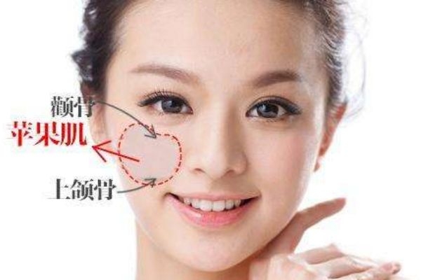 苹果肌在哪个位置示意图,苹果肌是哪个部位 苹果肌在哪个位置示意图,苹果肌是哪个部位