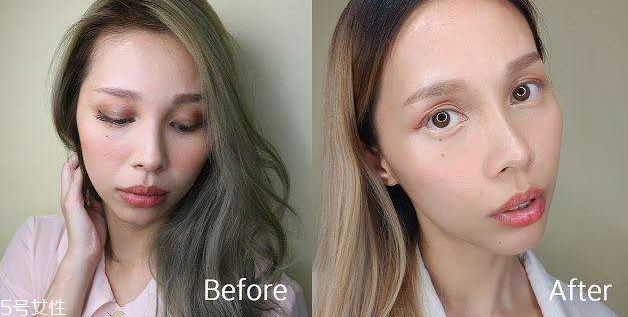 皮秒 冰敷,冰敷对皮炎红肿有效吗