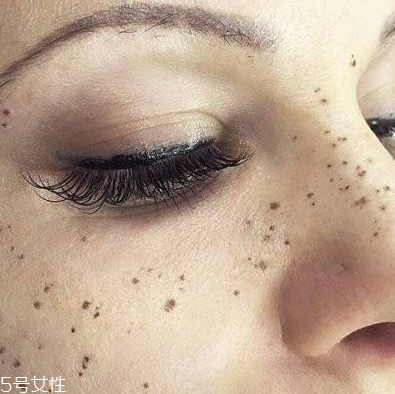 皮秒几次有效果,皮秒一个疗程几次