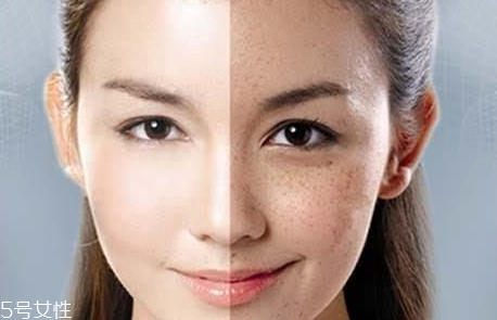 皮秒后要用修复产品吗,做完皮秒后用什么修复液