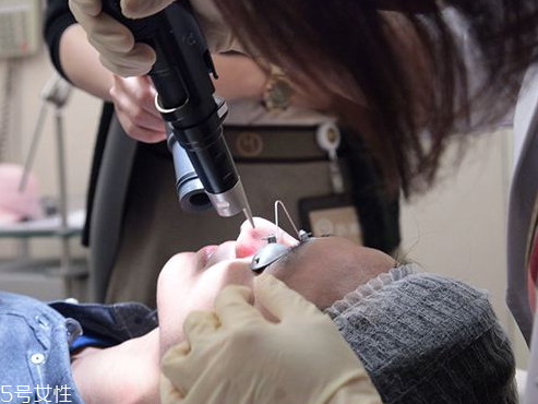 超皮秒后皮肤反干多久 超皮秒后皮肤反干多久