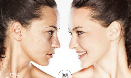 小气泡需要哪些产品,小气泡配合使用的产品