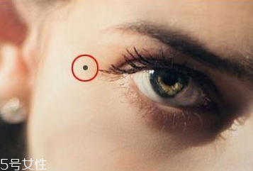 激光点痣恢复期多长时间,激光点痣恢复过程