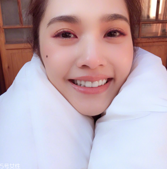 点痣后需要注意什么,点痣后需要注意什么事项