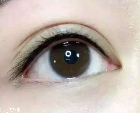 做完双眼皮多久可以做美瞳线,埋线双眼皮能戴美瞳吗