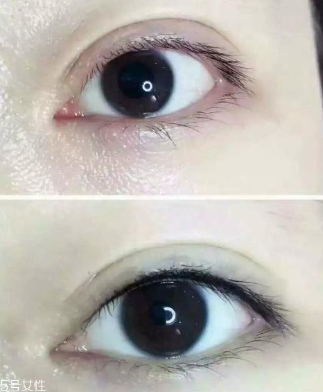 纹美瞳线眼睛会肿吗,美瞳线纹完眼睛会肿吗