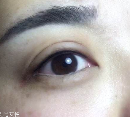 纹美瞳线后怎么护理,纹美瞳线过程