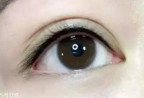 美瞳线会肿多久,美瞳线会肿几天