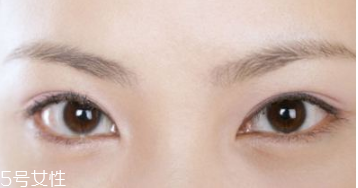 割双眼皮的后遗症不容忽视,割双眼皮的后遗症有哪些 割双眼皮的后遗症不容忽视,割双眼皮的后遗症有哪些