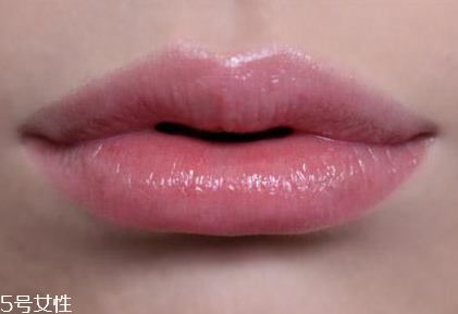 胶原蛋白丰唇能维持多久时间,嘟嘟唇几天恢复自然