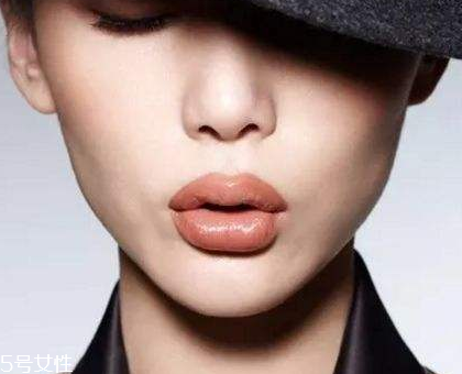 玻尿酸嘟嘟唇保持多久,玻尿酸嘟嘟唇多久恢复自然