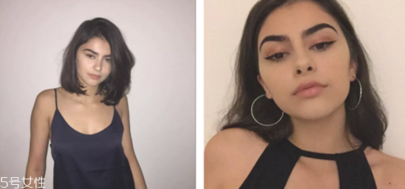 瘦脸针多大年龄打合适,多少岁可以打瘦脸针 瘦脸针多大年龄打合适,多少岁可以打瘦脸针