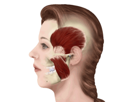 瘦脸针只针对咬肌吗,瘦脸针只瘦咬肌还是也瘦脸部 瘦脸针只针对咬肌吗,瘦脸针只瘦咬肌还是也瘦脸部