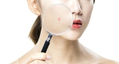 激光祛痘印视频,激光祛痘印过程视频