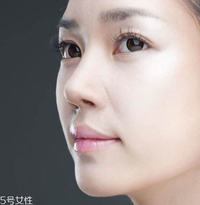 垫鼻子后需要注意什么,垫鼻子必须要垫鼻尖吗