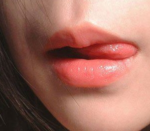 兔唇可以修复好吗,兔唇修复前后对比