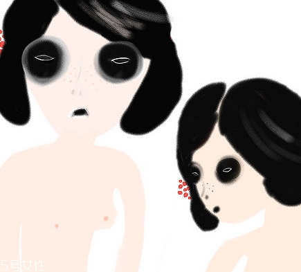 黑眼圈可以做什么手术去除掉,黑眼圈可以手术去除吗