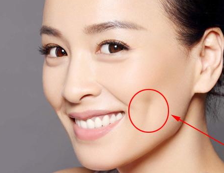 人造酒窝自然吗,人工酒窝和天然酒窝区别