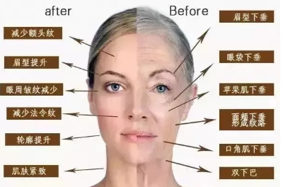 爱贝芙一针一般多少钱,爱贝芙注射多少钱一只