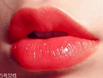 玻尿酸丰唇珠不好看怎么办,玻尿酸丰唇唇珠要打多少好看
